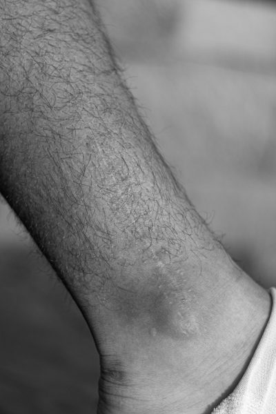 SCARS OF THE GAME – The Criterion