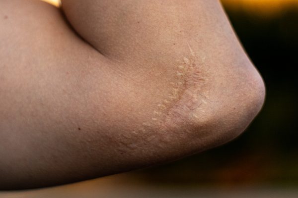 SCARS OF THE GAME – The Criterion